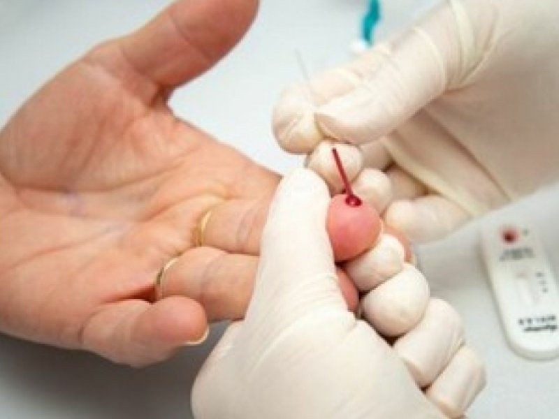 Estudo indica possível avanço rumo à cura do HIV