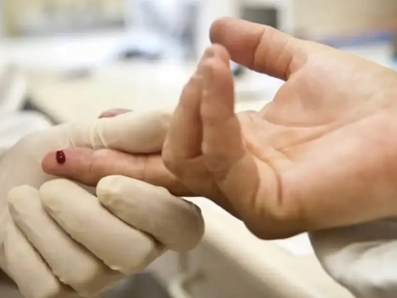 Sesab desmente surto de HIV entre adolescentes na Bahia