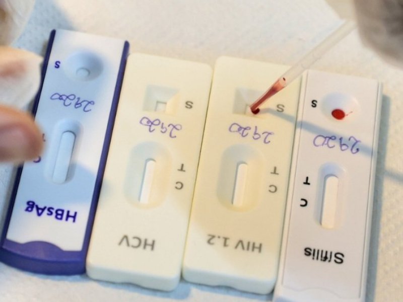 Mais de 24 mil exames foram feitos em postos de testagem de ISTs no Carnaval da Bahia