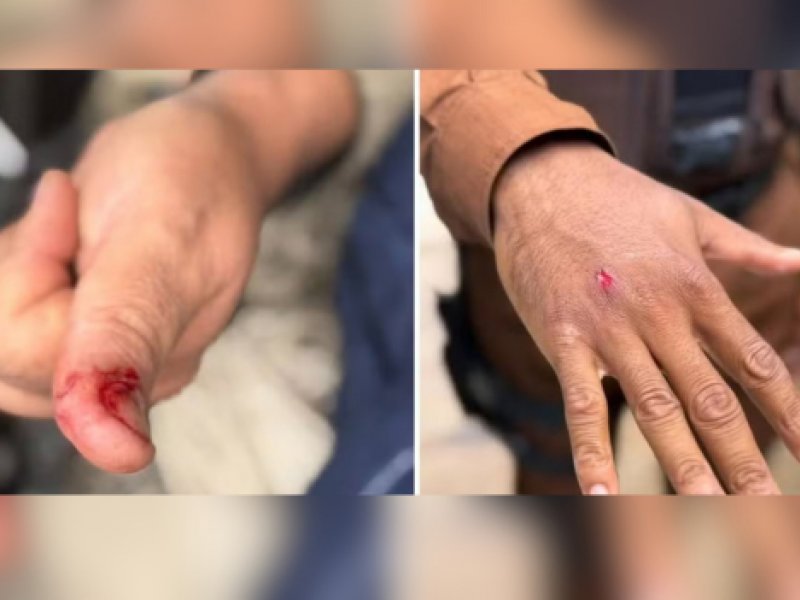 Macaco-prego invade casas, ingere álcool e medicamentos e deixa cinco feridos em Salvador