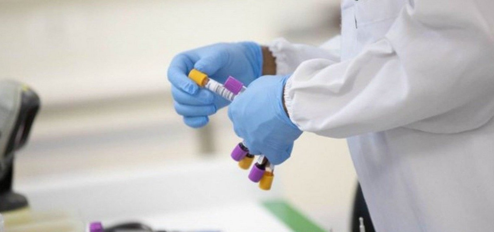 Ministério da Saúde confirma segundo caso de reinfecção por Covid-19 no Brasil 