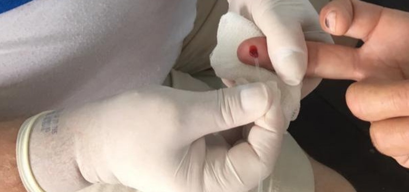 Câmara aprova obrigatoriedade do sigilo sobre condição de pacientes com HIV