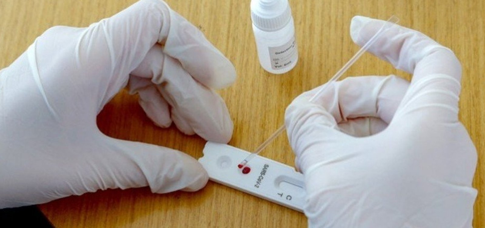 Testes de vacinas nacionais contra a Covid-19 têm previsão de término para depois de 2022