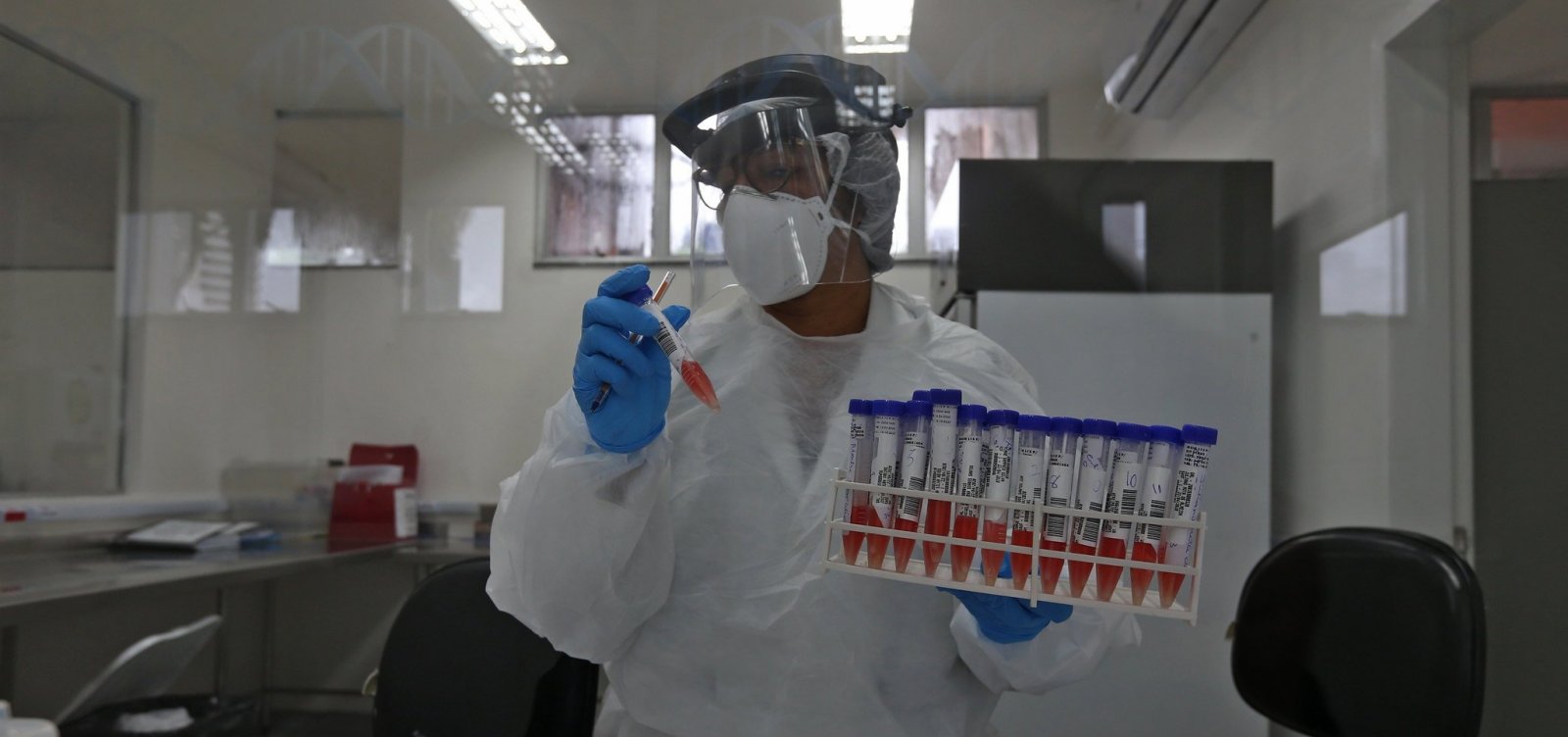 Laboratório Central da Bahia identifica variante peruana da Covid-19 no estado
