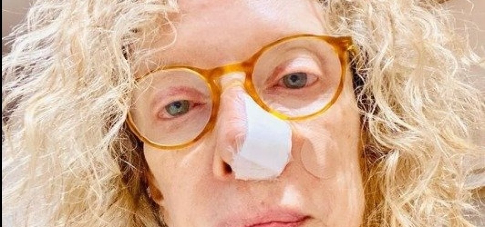 Marília Gabriela passa por cirurgia depois de descobrir câncer no nariz