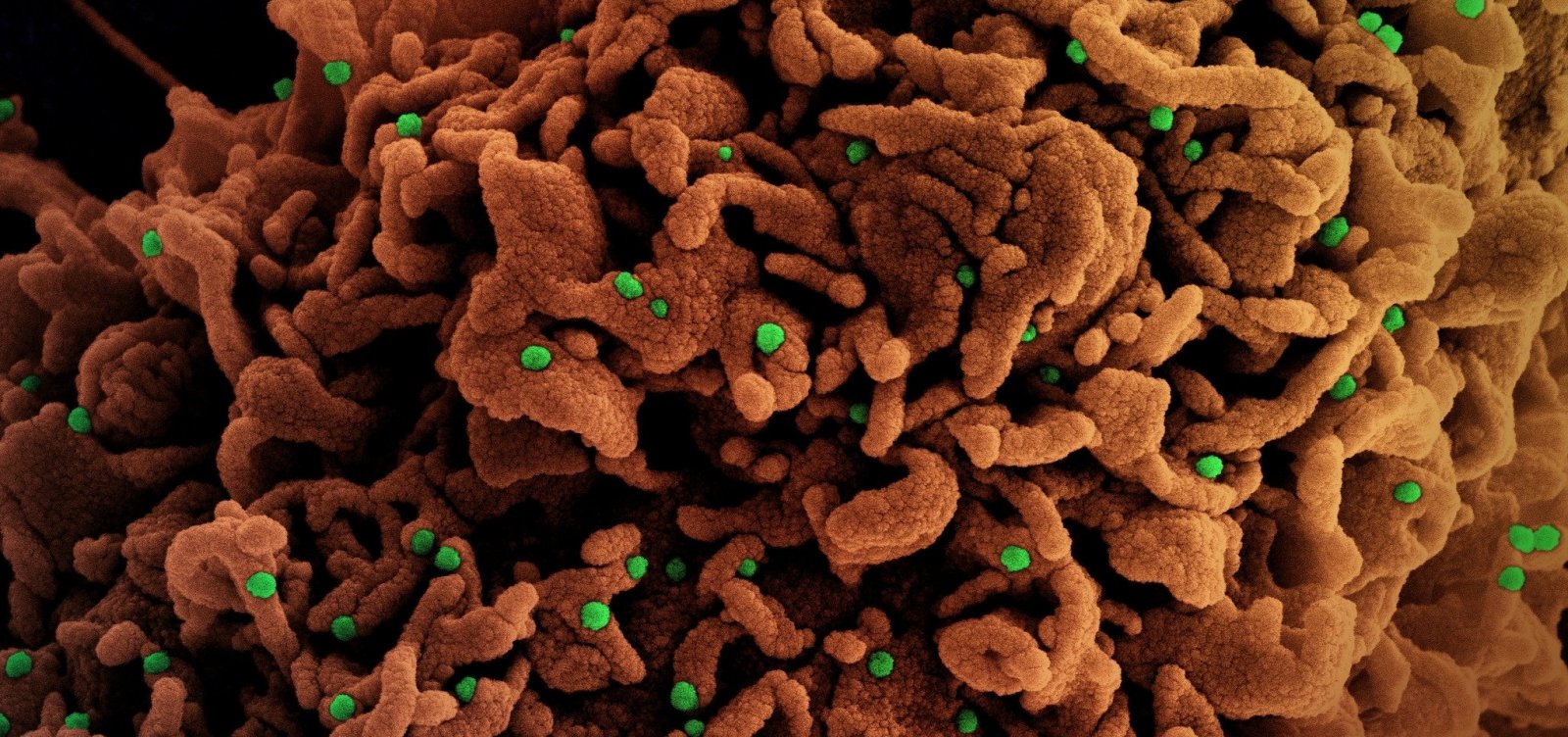 Fiocruz detecta novas mutações em variantes do coronavírus no Brasil