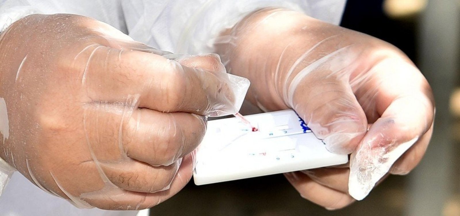 Salvador registra 621 novos casos de Covid-19 e 16 mortes pela doença em 24 horas