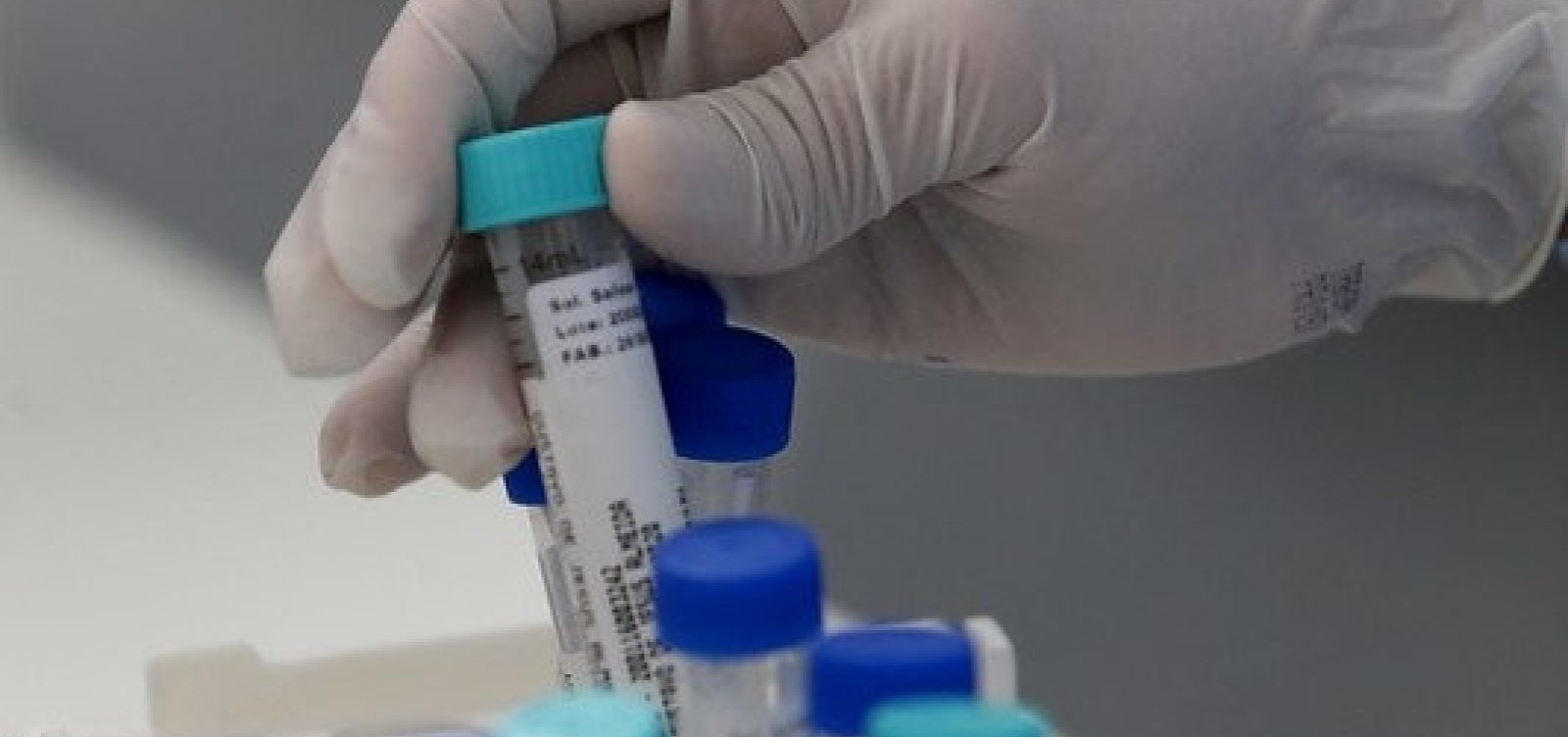 Salvador registra 111 casos de Covid-19 e uma morte pela doença em 24 horas