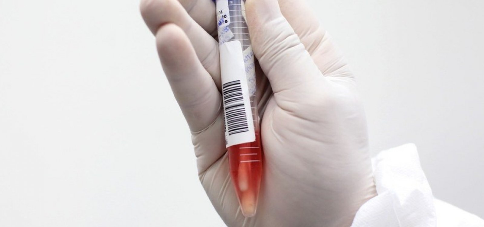 Sem mortes em 24h, Salvador registra 60 novos casos de Covid