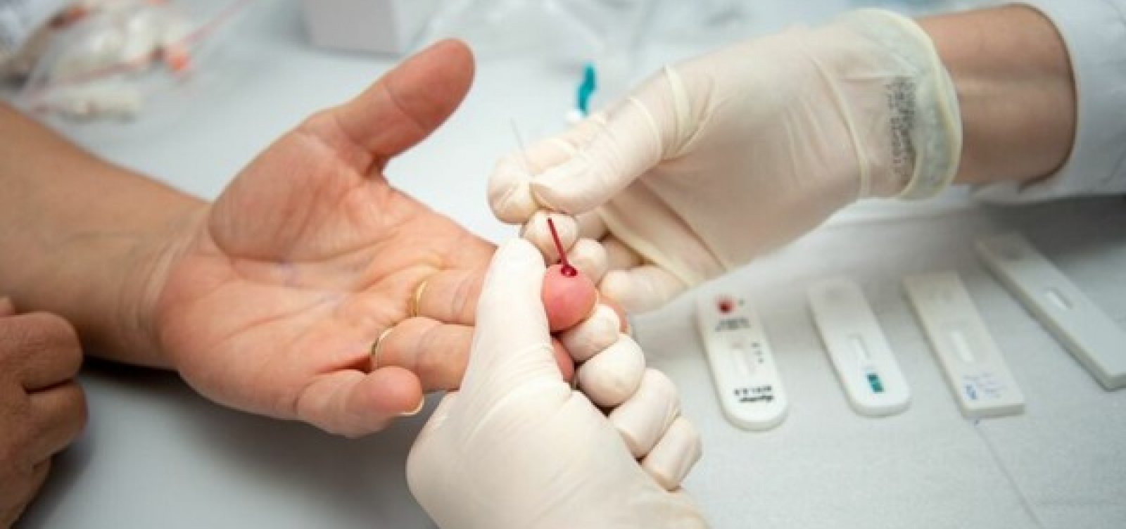 Casos detectados de HIV no Brasil caíram 25% em 2020 