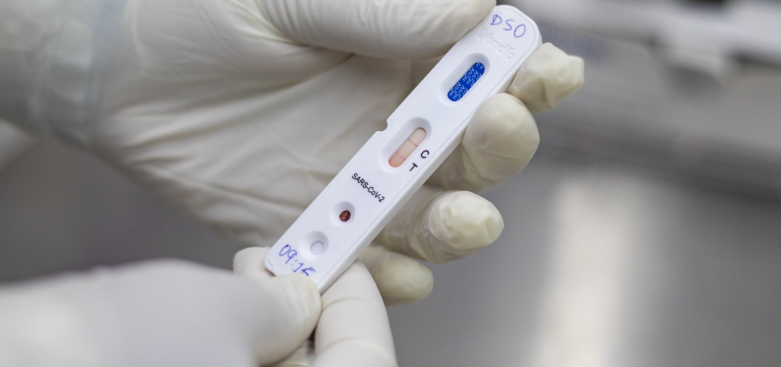 Mesmo com aumento de casos, cientistas sul-africanos não veem maior gravidade em ômicron