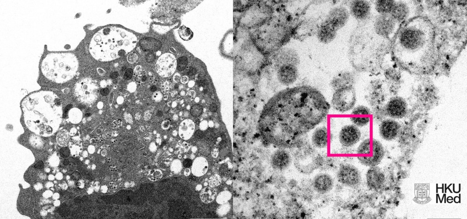 Reino Unido registra primeira morte causada por variante &ocirc;micron