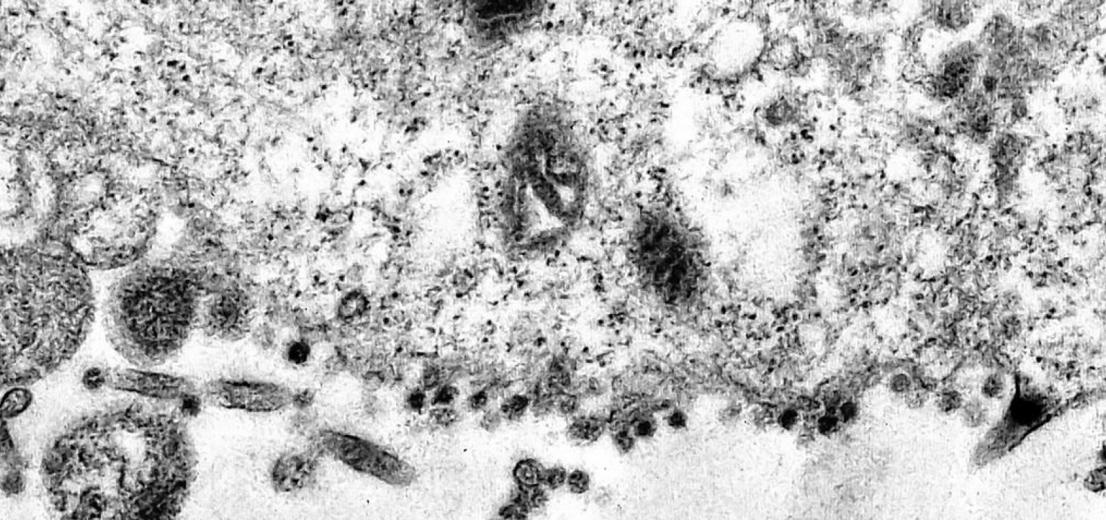 Gripe faz atendimentos crescerem mais de 500% em alguns municípios baianos 