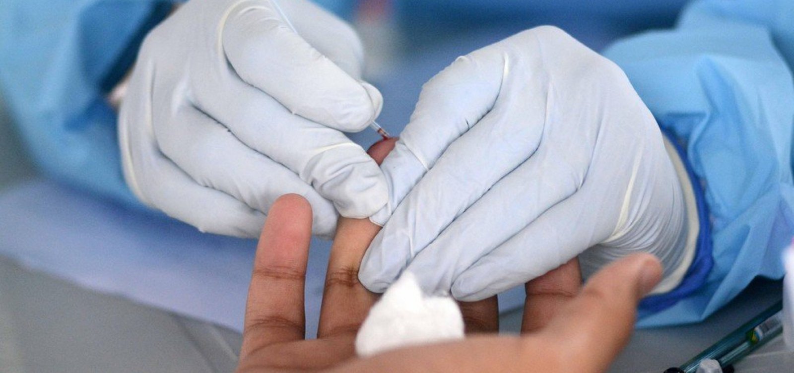 Em apenas um dia de testagem, Bonfim tem 30 casos confirmados de Covid-19