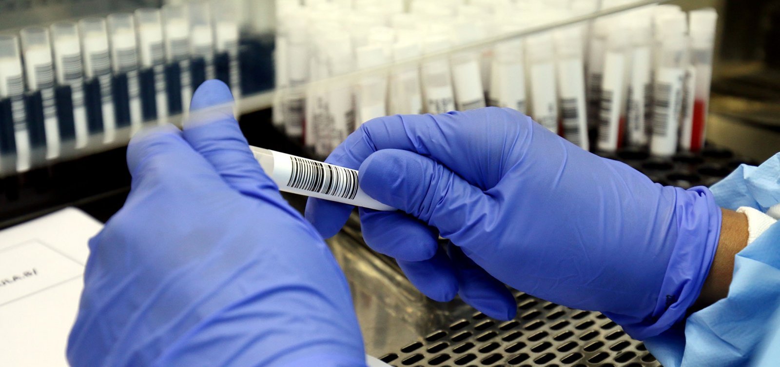 Bahia registra 18 mortes por Covid e mais 991 novos casos da doen&ccedil;a em 24h