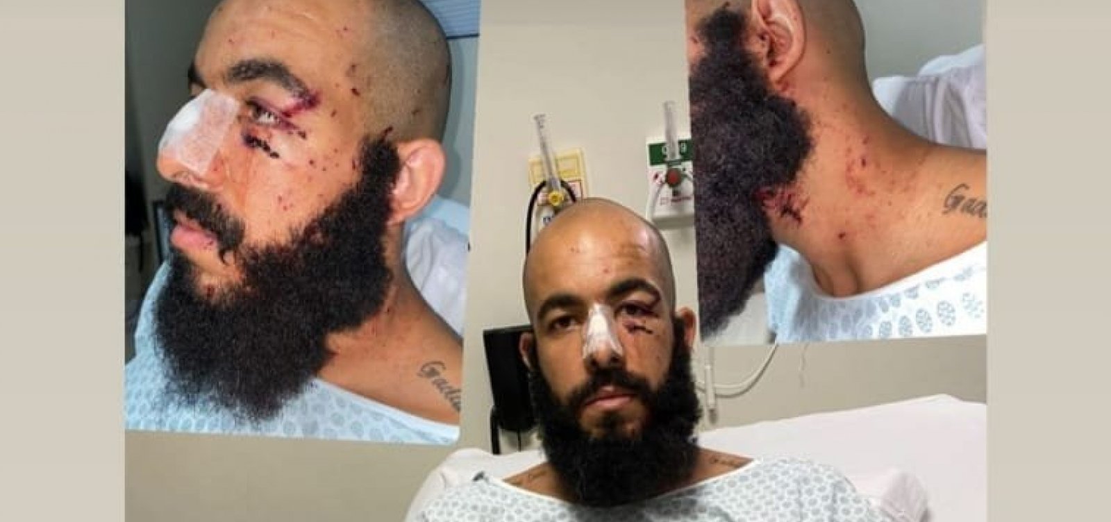 Vítima de ataque, goleiro do Bahia publica foto com ferimentos e questiona: "Até quando?"