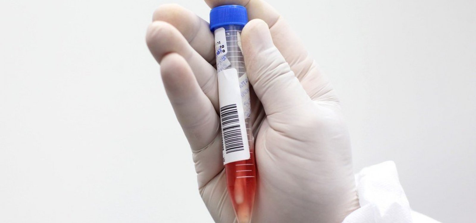 Salvador registra 266 novos casos de Covid e uma morte pela doen&ccedil;a nas &uacute;ltimas 24h