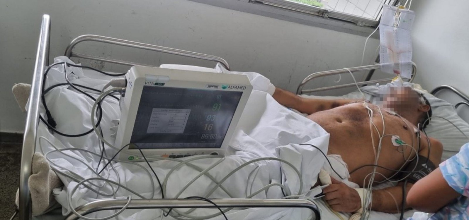Família denuncia negligência médica em paciente com câncer no cérebro no Hospital Roberto Santos