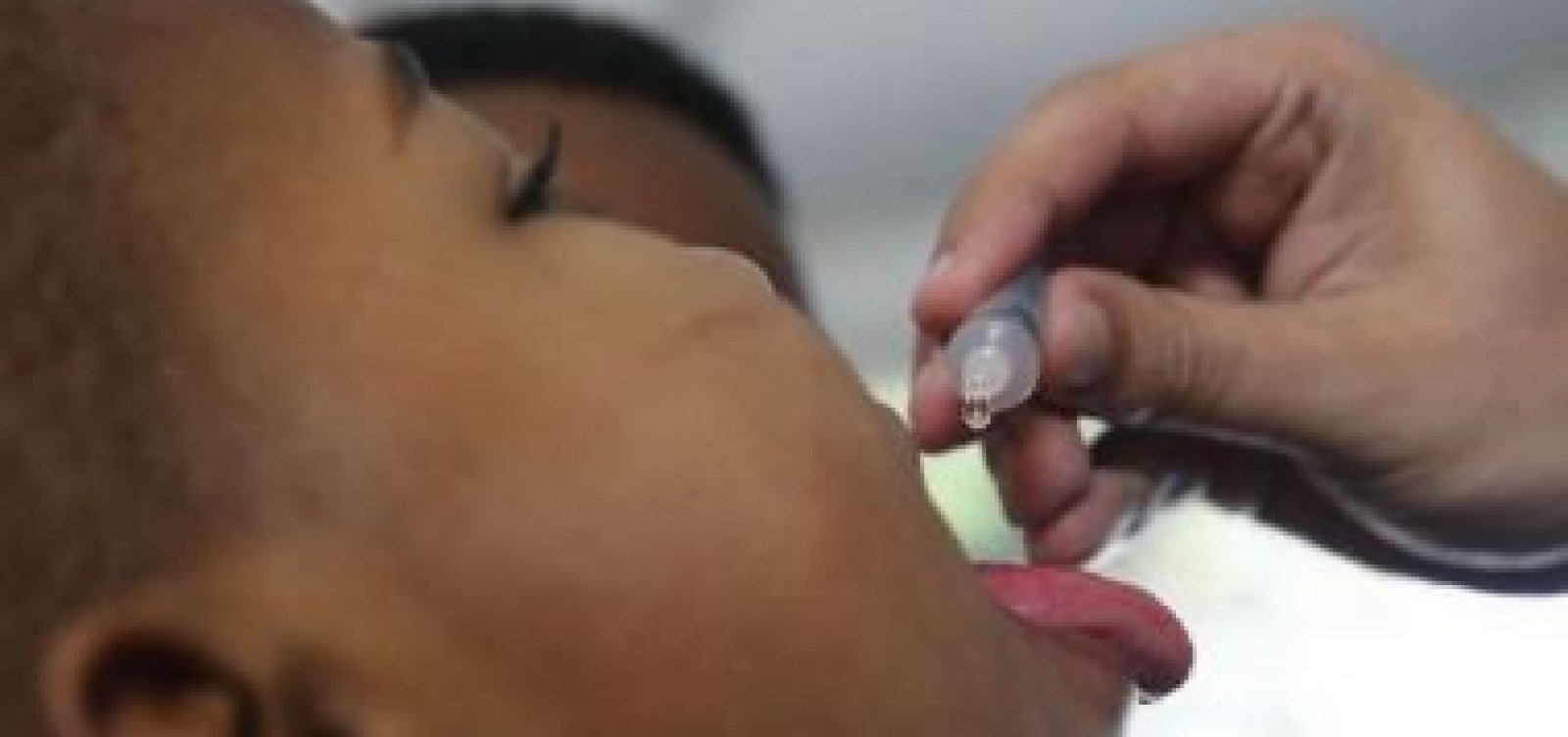 Fiocruz alerta para risco de reintrodução da poliomielite no Brasil