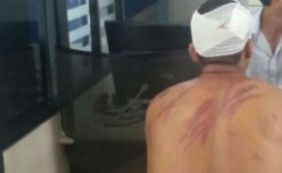 Preso de 22 anos é espancado por colegas em conjunto penal de Teixeira