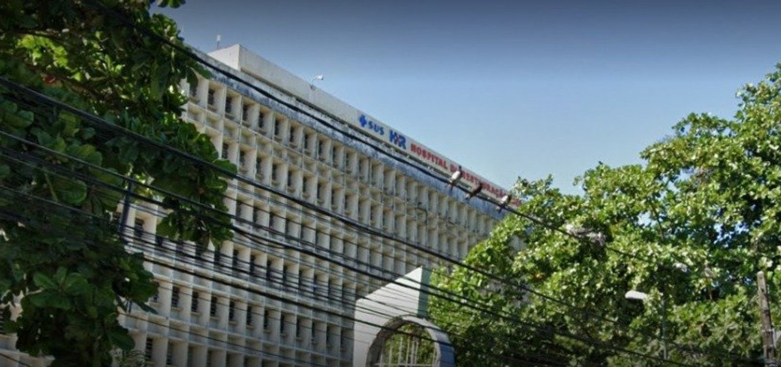 Mulher tem corpo queimado após tentativa de feminicídio em Recife