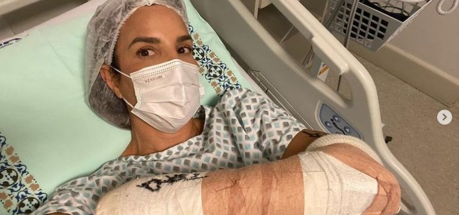 Após sofrer acidente esquiando no exterior, Ivete passa por cirurgia no braço 