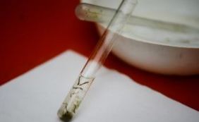 Colômbia registra mais de 37 mil vítimas do vírus Zika