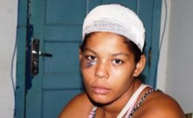 Mulher é agredida por marido com facada na cabeça em Itapebi