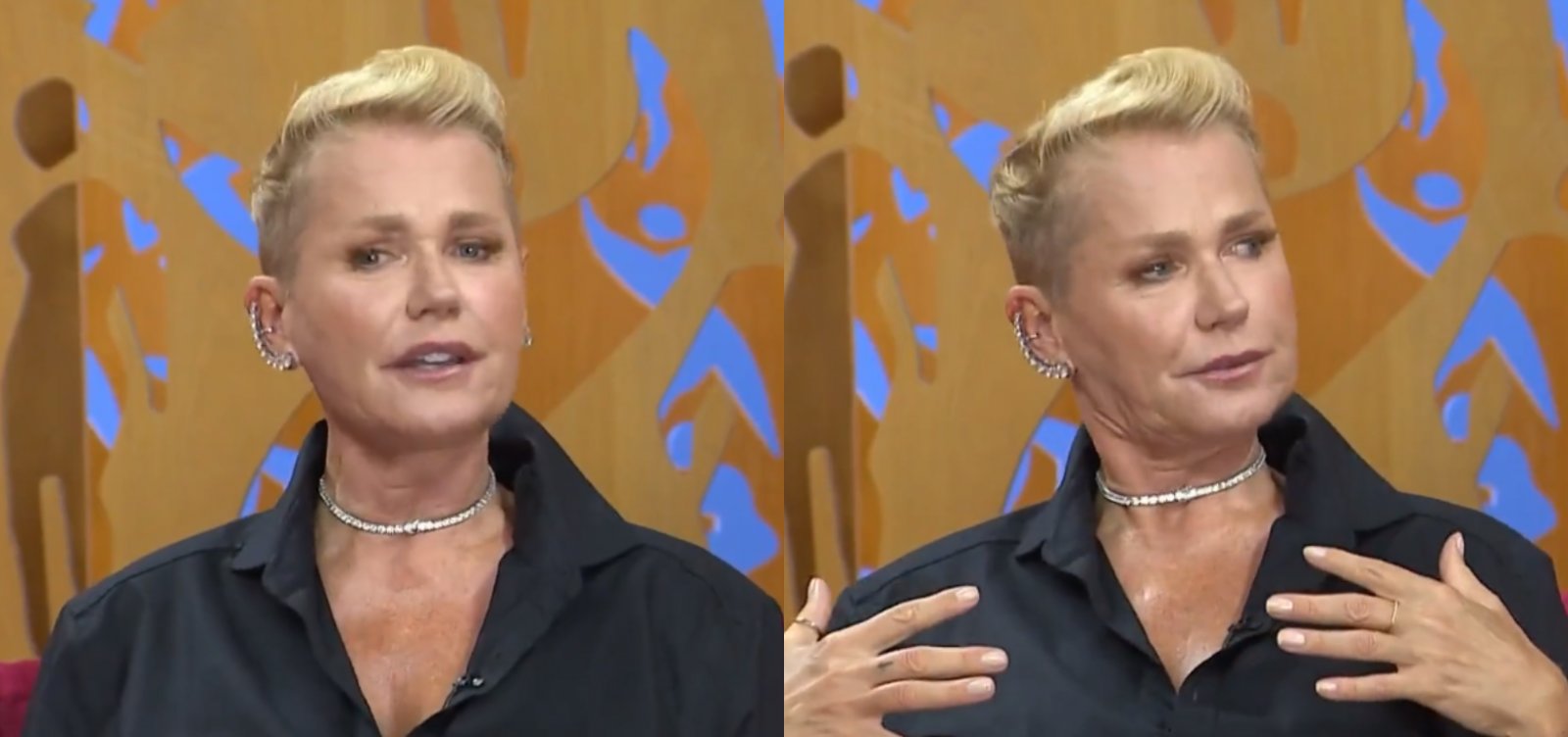 Xuxa revela que foi submetida a procedimentos estéticos invasivos sem autorização dela