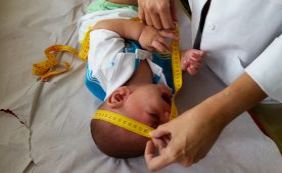 Mutirão atende bebês com microcefalia para detectar problemas auditivos