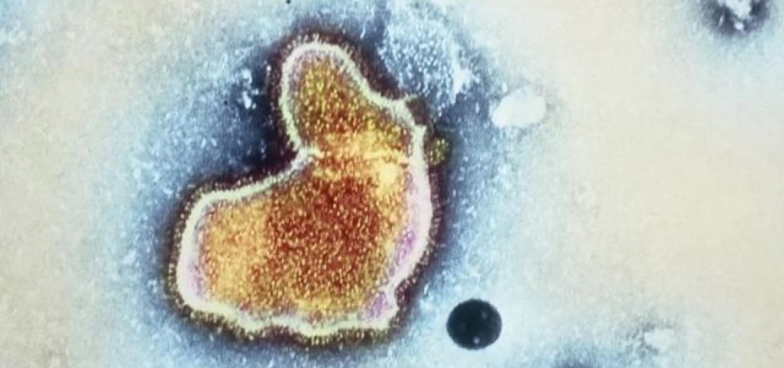 Estados Unidos aprovam primeira vacina do mundo contra VSR, que causa bronquite