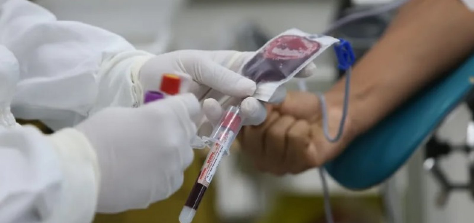 Estoque em nível crítico: Hemoba lança campanha e pede doações na Bahia