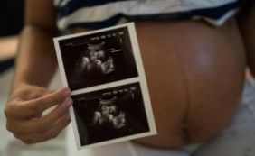 Novo estudo diz que microcefalia ocorre em 1% dos casos de grávidas com Zika