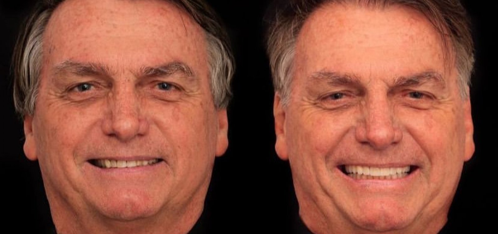 Bolsonaro faz harmonização dentária em Goiânia