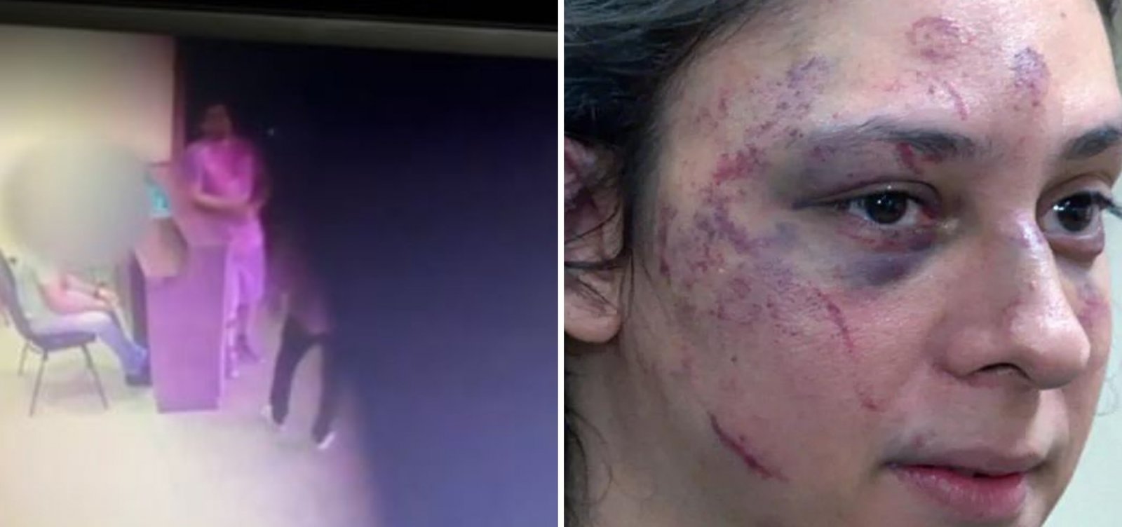 Porteiro que presenciou agressão a Victor Meyniel é autuado por omissão de socorro