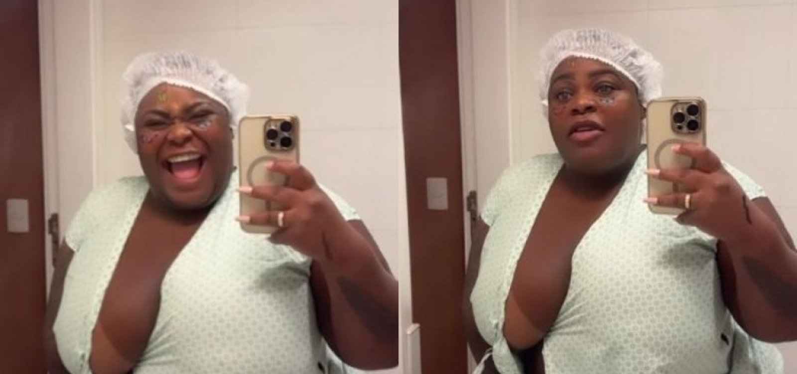 Jojo Todynho passa mal após bariátrica: "Muita luta"