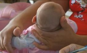 Após novo critério, 550 casos de microcefalia são notificados na Bahia