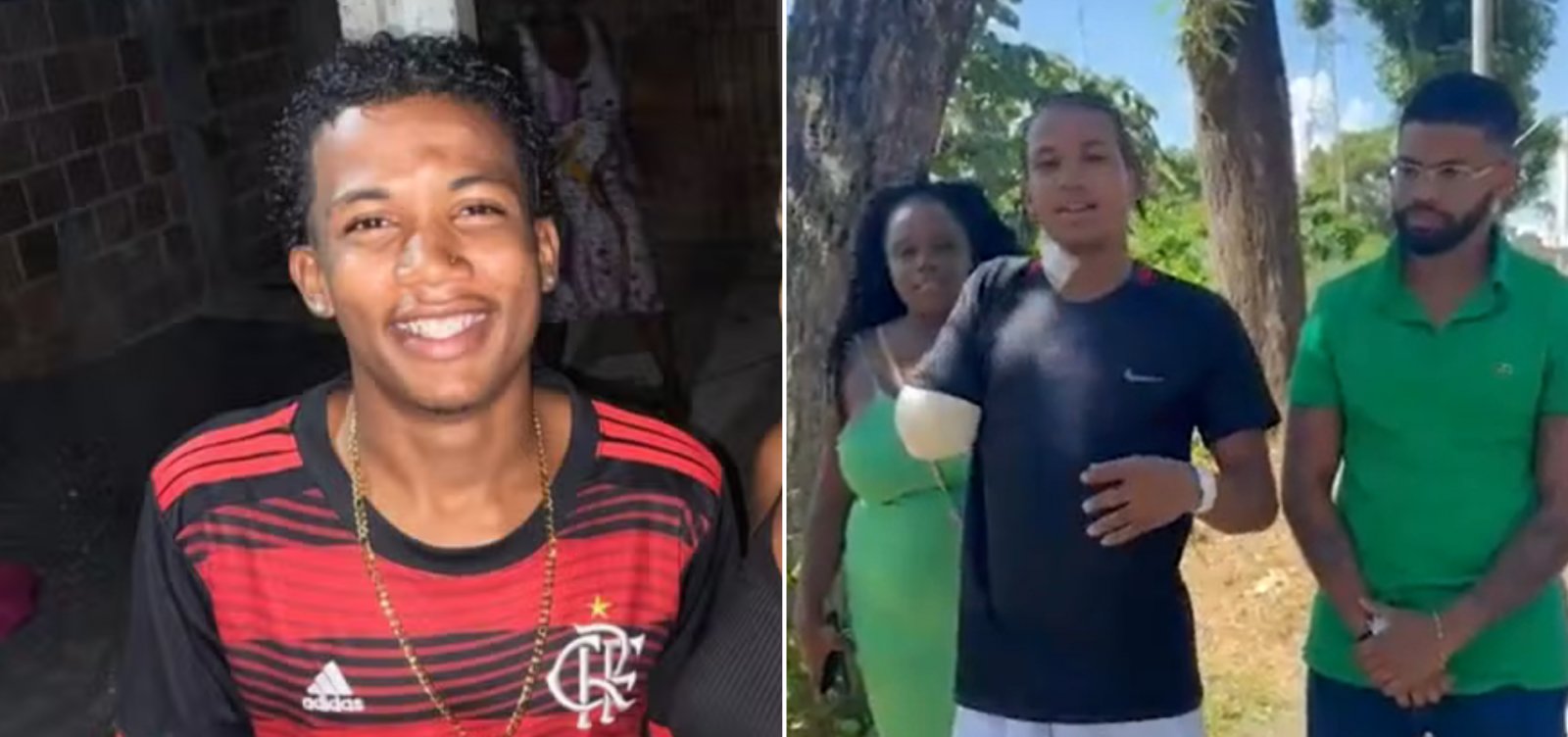 Jovem que teve braço amputado após acidente em parque de diversões de Salvador recebe alta hospitalar