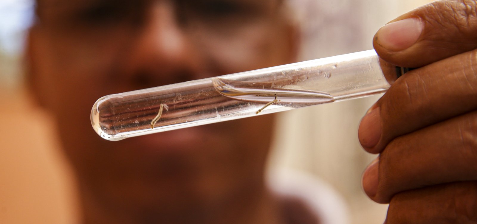 Número de mortes por dengue na Bahia sobe para 43, segundo Sesab 