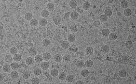 Estudo brasileiro indica ligação de vírus zika com outra doença neurológica