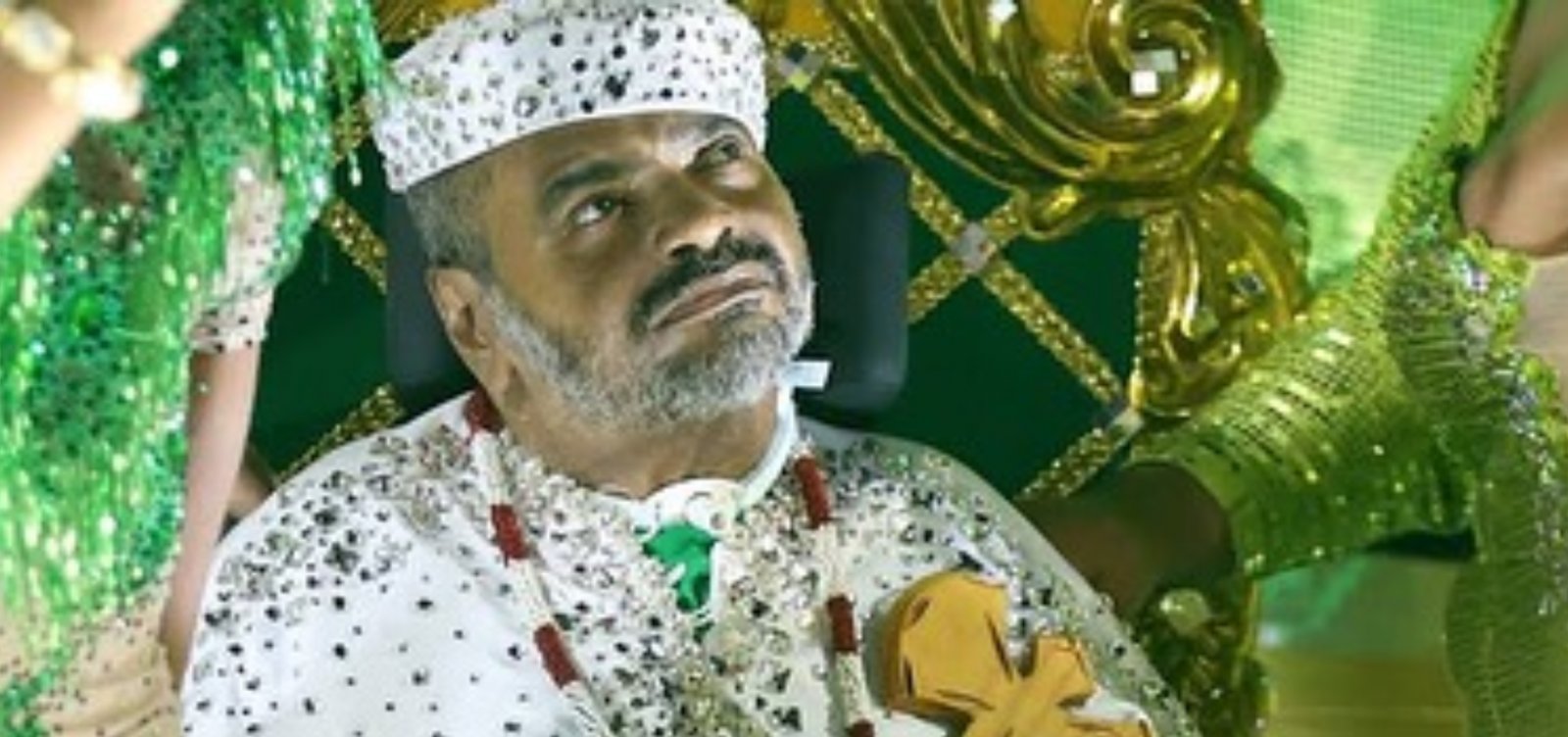 Arlindo Cruz volta a ser hospitalizado para realizar procedimento odontológico