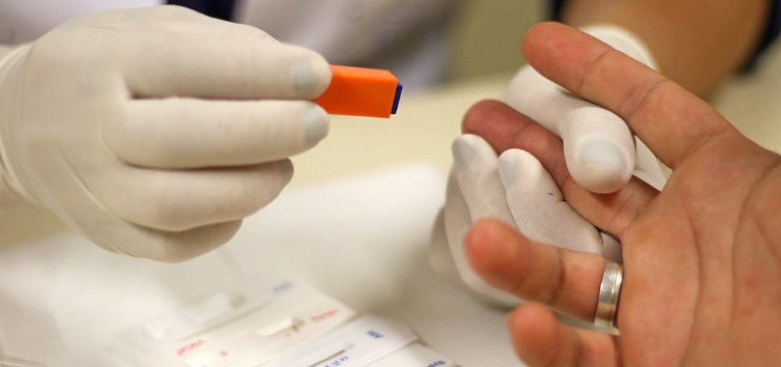 Ministério da Saúde orienta farmácias a realizar testes rápidos de HIV, hepatites virais, sífilis e ISTs