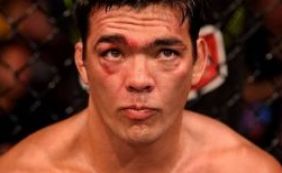 UFC: Machida admite uso de substância proibida e luta é cancelada