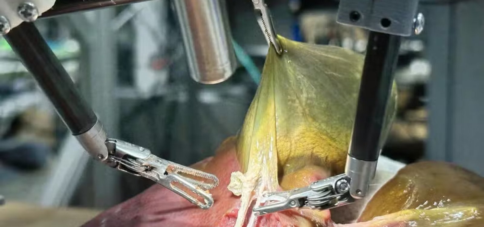 Robô faz cirurgia guiado por IA sem ajuda humana