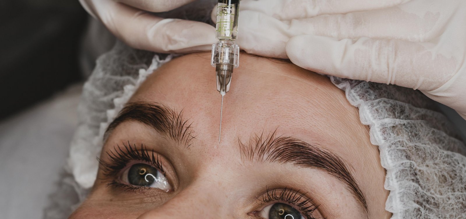 Anvisa determina apreensão de botox falsificado