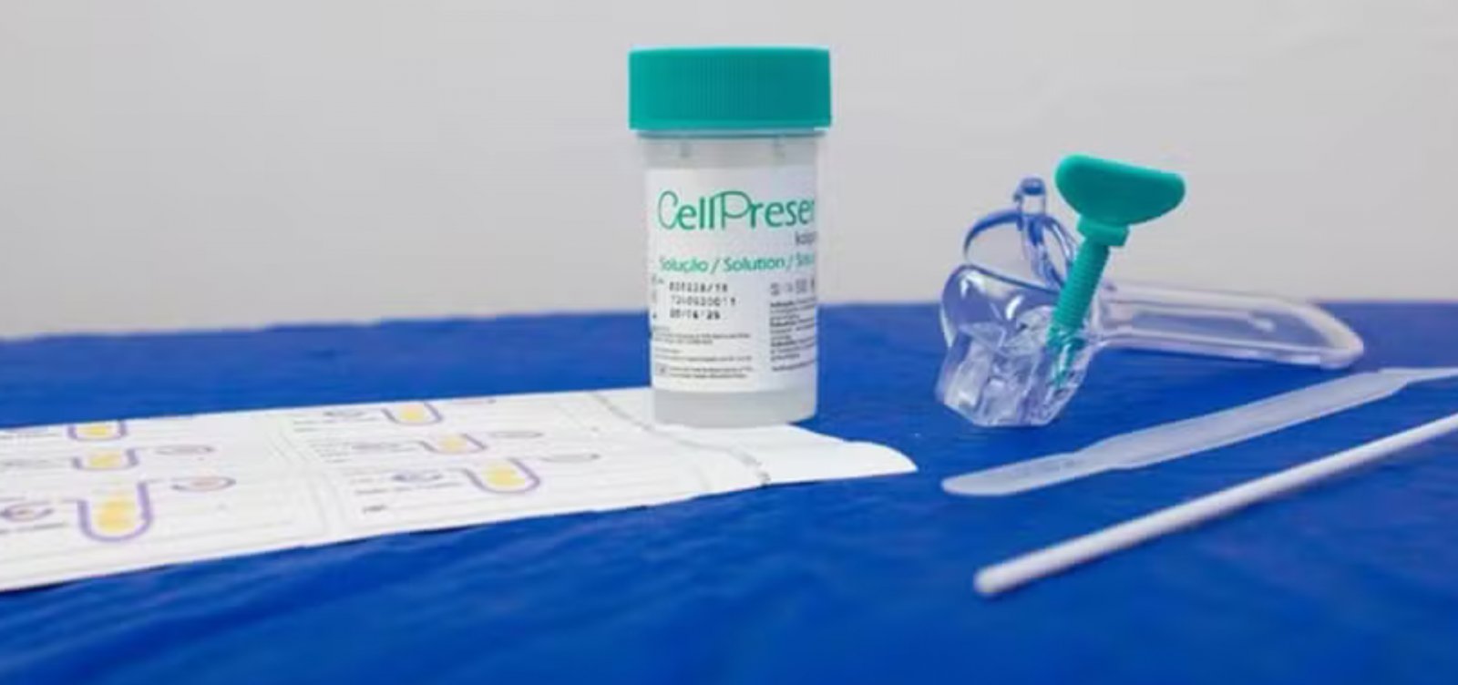 SUS começa a oferecer teste de DNA-HPV para rastrear câncer do colo do útero