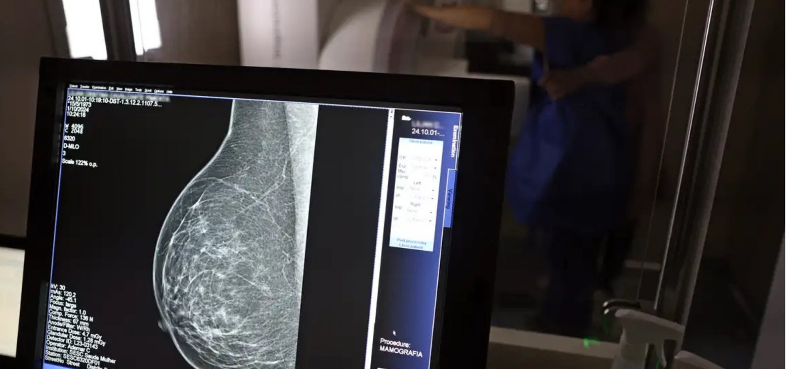  Governo da Bahia inicia Outubro Rosa com 40 mil mamografias em todo o estado
