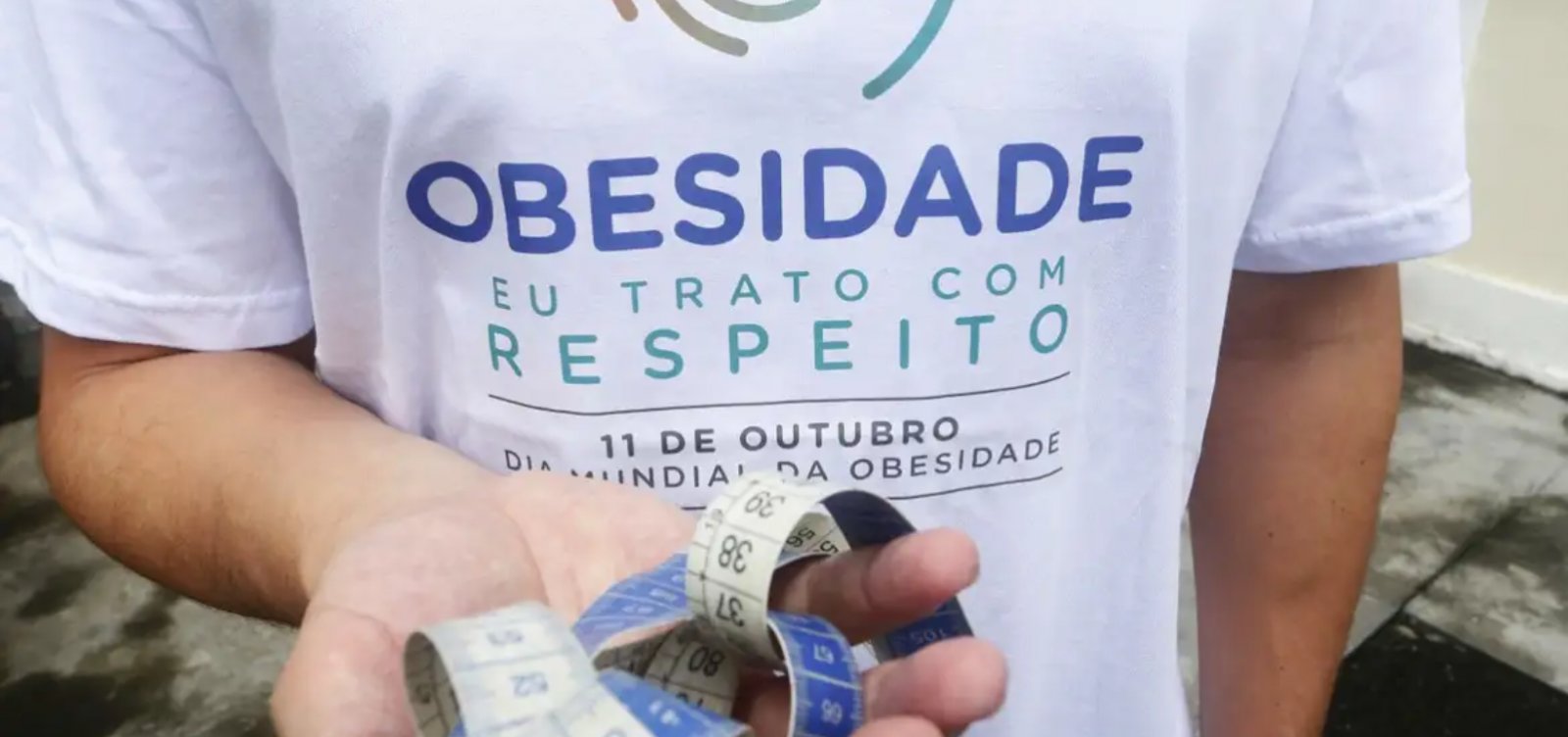 Obesidade infantil pode custar R$ 3,8 bilhões ao SUS até 2060, aponta estudo