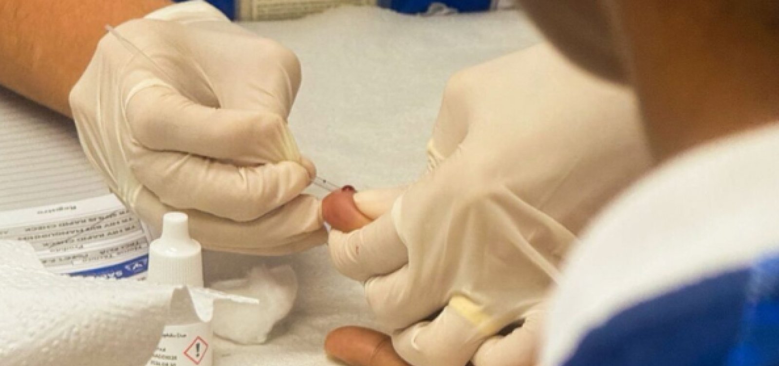 Salvador oferece testagem gratuita de sífilis e HIV neste fim de semana