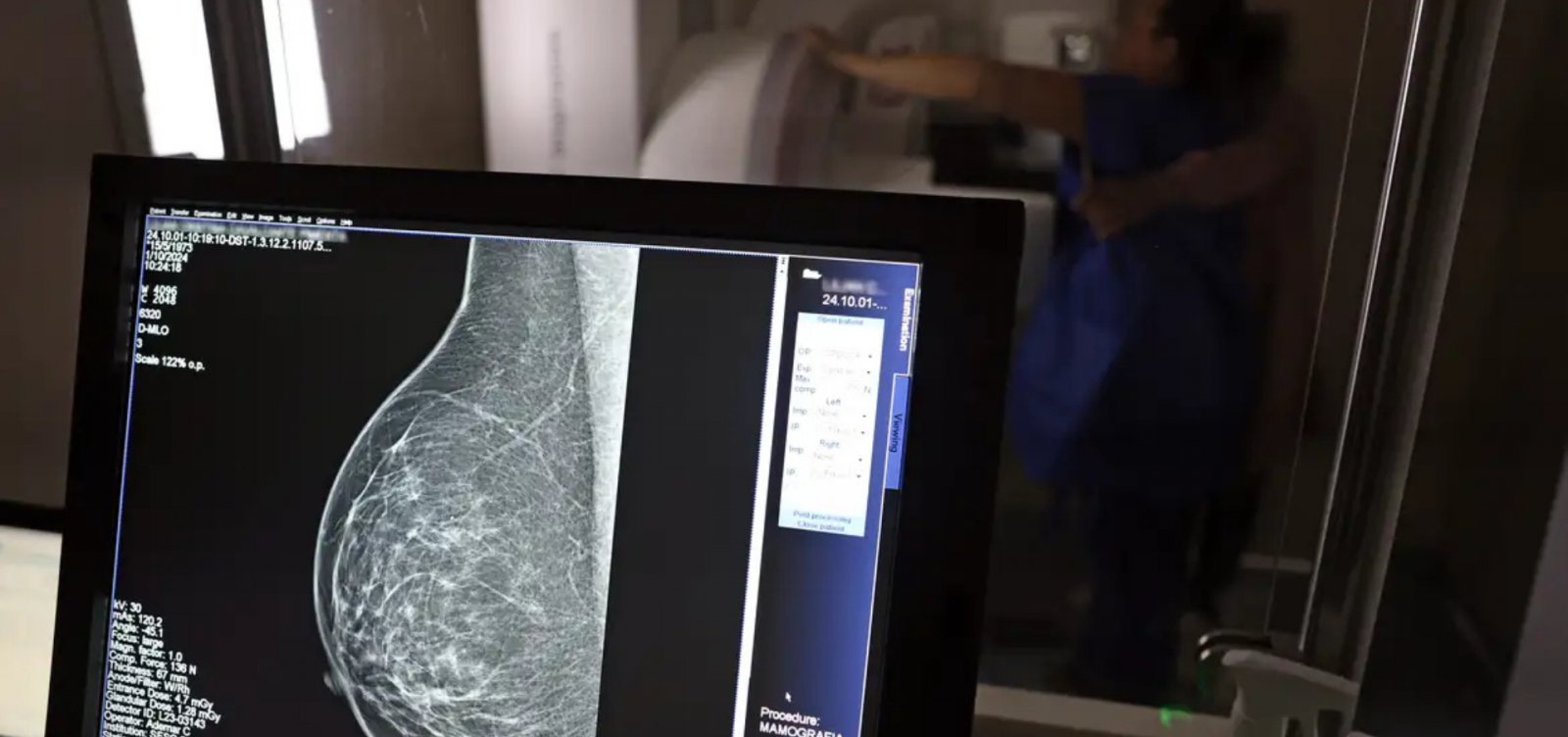 Falta de acesso a mamógrafos limita prevenção do câncer de mama